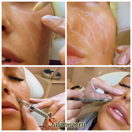 Косметология в центре красоты "ZigZag"